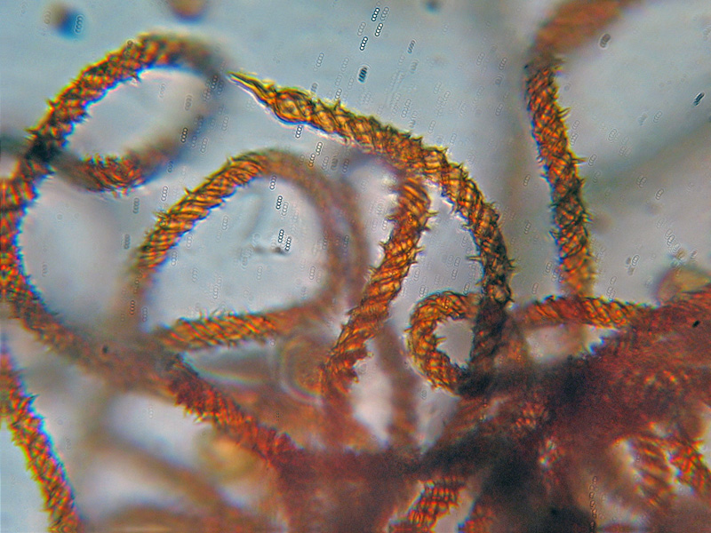 Metatrichia vesparium